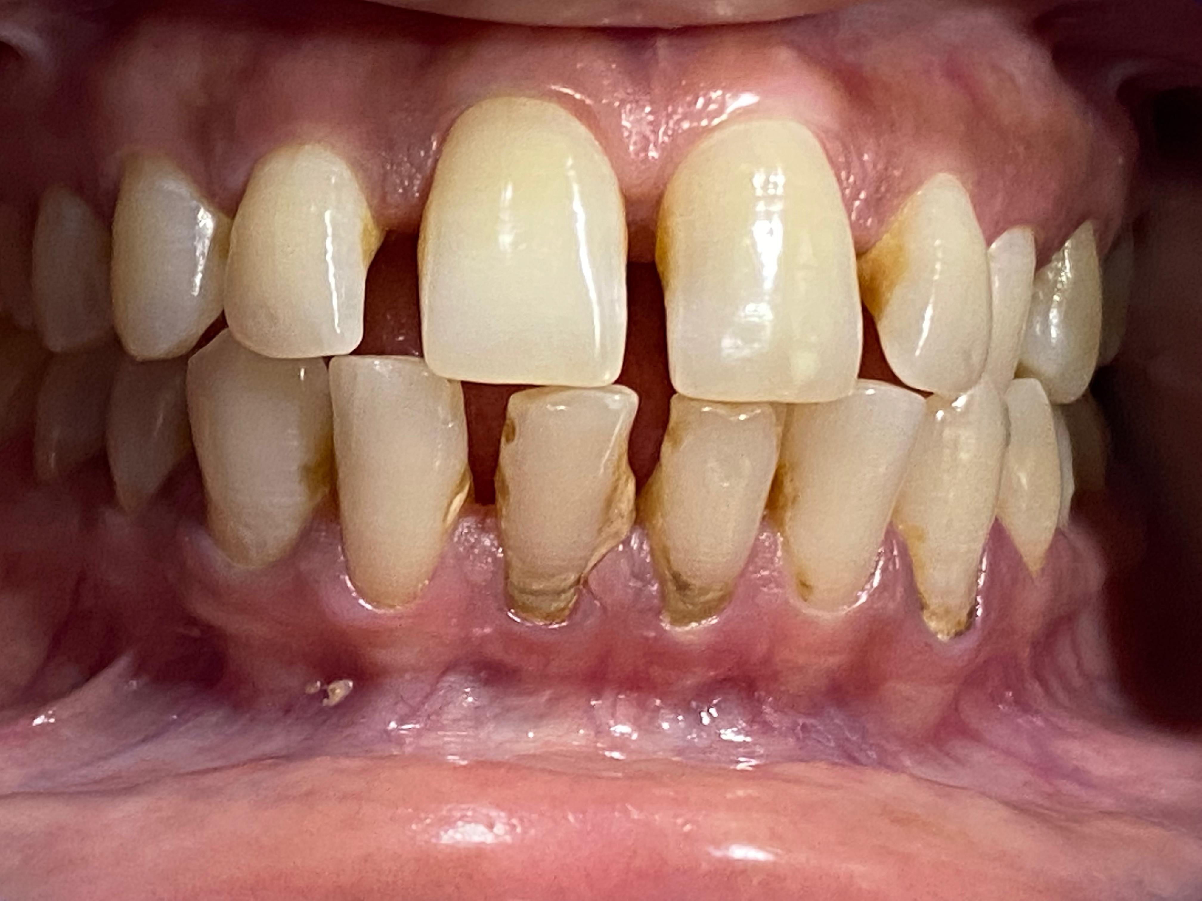 Before Image